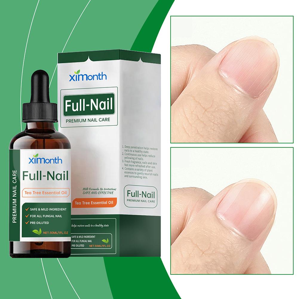 Herbal Wellness Tea - 30ml Nail Fungus Tea Tree Essential