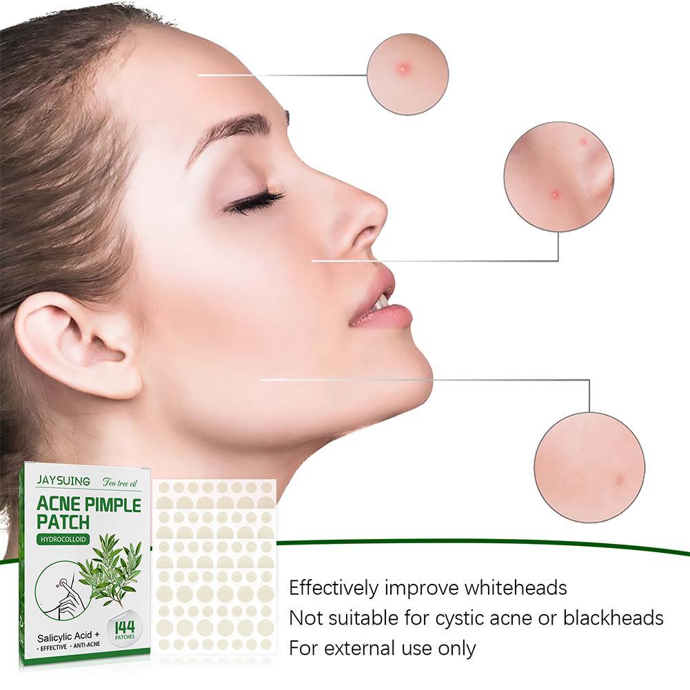 144pcs Acne Pimple Patches Tra – Herbal Wellness Tea Bewertung und Preis