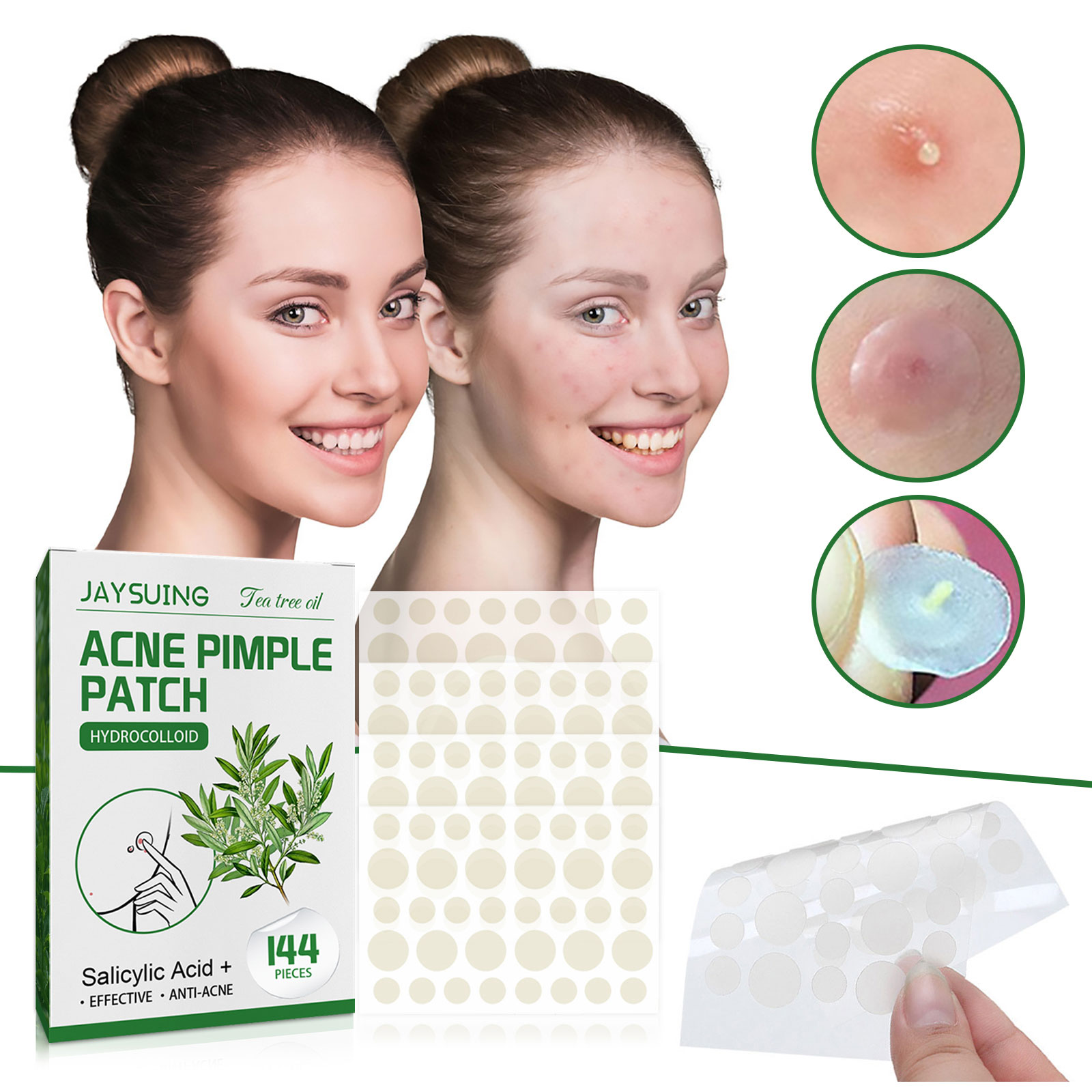 Acne Pimple Patches Translucen – Herbal Wellness Tea Bewertung und Preis