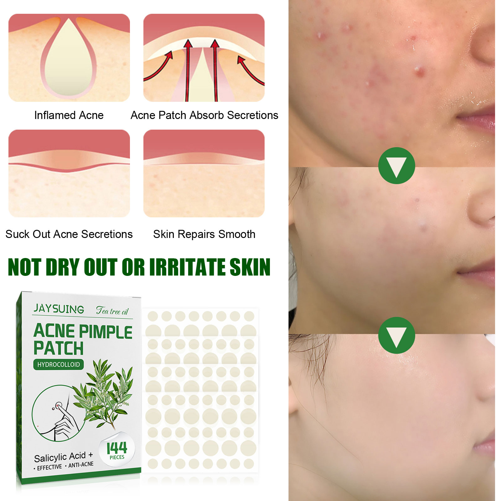Acne Pimple Patches Translucen – Herbal Wellness Tea Bewertung und Preis